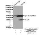 ERP29 Antibody in Immunoprecipitation (IP)