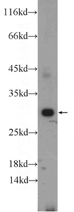 ERP29 Antibody in Western Blot (WB)