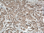 ACTN3 Antibody in Immunohistochemistry (Paraffin) (IHC (P))