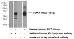 ACPP Antibody in Western Blot (WB)
