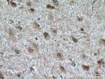 TALPID3 Antibody in Immunohistochemistry (Paraffin) (IHC (P))