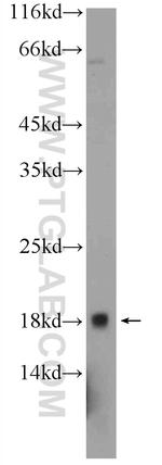 C10orf67 Antibody in Western Blot (WB)