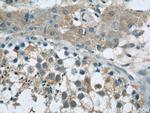 TEX15 Antibody in Immunohistochemistry (Paraffin) (IHC (P))