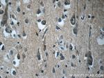 RAB3GAP2 Antibody in Immunohistochemistry (Paraffin) (IHC (P))