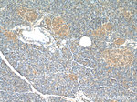 Tuberin Antibody in Immunohistochemistry (Paraffin) (IHC (P))