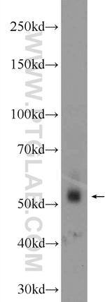 ZNF71 Antibody in Western Blot (WB)