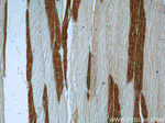 MN1 Antibody in Immunohistochemistry (Paraffin) (IHC (P))