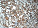 MN1 Antibody in Immunohistochemistry (Paraffin) (IHC (P))