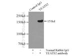 YEATS2 Antibody in Immunoprecipitation (IP)