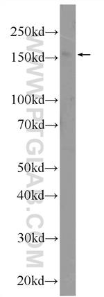 YEATS2 Antibody in Western Blot (WB)