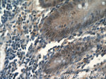 MDC1 Antibody in Immunohistochemistry (Paraffin) (IHC (P))