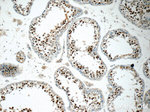 MDC1 Antibody in Immunohistochemistry (Paraffin) (IHC (P))