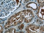 EFTUD1 Antibody in Immunohistochemistry (Paraffin) (IHC (P))