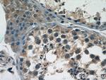 BTBD16 Antibody in Immunohistochemistry (Paraffin) (IHC (P))