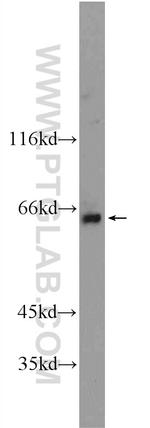 BTBD16 Antibody in Western Blot (WB)