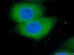 VHL Antibody in Immunocytochemistry (ICC/IF)