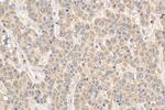 VHL Antibody in Immunohistochemistry (Paraffin) (IHC (P))