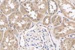 VHL Antibody in Immunohistochemistry (Paraffin) (IHC (P))