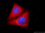 SMC4 Antibody in Immunocytochemistry (ICC/IF)