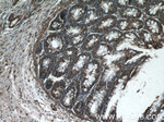 SMC4 Antibody in Immunohistochemistry (Paraffin) (IHC (P))