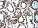 SMC4 Antibody in Immunohistochemistry (Paraffin) (IHC (P))