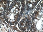 SMC4 Antibody in Immunohistochemistry (Paraffin) (IHC (P))