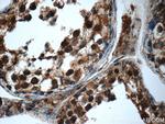 SMC4 Antibody in Immunohistochemistry (Paraffin) (IHC (P))