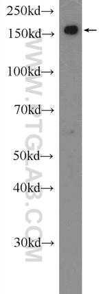 SMC4 Antibody in Western Blot (WB)