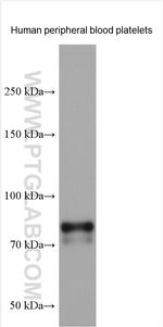 TPOR/MPL Antibody in Western Blot (WB)