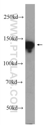 ATXN2L Antibody in Western Blot (WB)