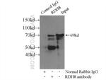 FUBP1 Antibody in Immunoprecipitation (IP)