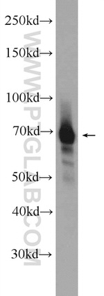 FUBP1 Antibody in Western Blot (WB)