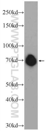 FUBP1 Antibody in Western Blot (WB)