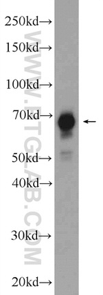 FUBP1 Antibody in Western Blot (WB)