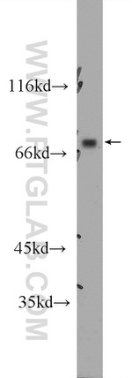 SLC22A23 Antibody in Western Blot (WB)