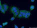 HDAC10 Antibody in Immunocytochemistry (ICC/IF)