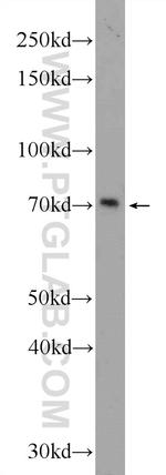 HIC1 Antibody in Western Blot (WB)