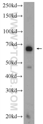 C10orf68 Antibody in Western Blot (WB)