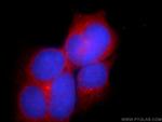 C10orf68 Antibody in Immunocytochemistry (ICC/IF)