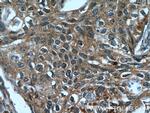 C10orf68 Antibody in Immunohistochemistry (Paraffin) (IHC (P))