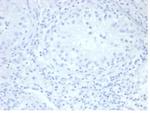 Alkaline Phosphatase (Placental)/PLAP (Germ Cell Tumor Marker) Antibody in Immunohistochemistry (Paraffin) (IHC (P))