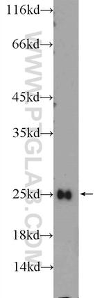 FEV Antibody in Western Blot (WB)