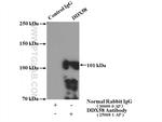 DDX58 Antibody in Immunoprecipitation (IP)