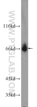 TTC26 Antibody in Western Blot (WB)