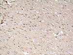 SIPA1L1 Antibody in Immunohistochemistry (Paraffin) (IHC (P))