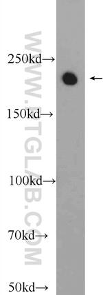 SIPA1L1 Antibody in Western Blot (WB)