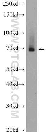 BTNL2 Antibody in Western Blot (WB)