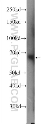 BTNL2 Antibody in Western Blot (WB)