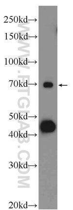 BTNL2 Antibody in Western Blot (WB)