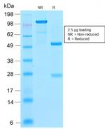 Ferritin, Light Chain (FTL) Antibody in SDS-PAGE (SDS-PAGE)